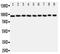 Signal Transducer And Activator Of Transcription 6 antibody, PA1691, Boster Biological Technology, Western Blot image 