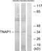 TNF Alpha Induced Protein 1 antibody, A30488, Boster Biological Technology, Western Blot image 