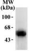 Dopa Decarboxylase antibody, GTX30448, GeneTex, Western Blot image 