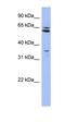 Prolyl 4-Hydroxylase, Transmembrane antibody, orb326231, Biorbyt, Western Blot image 