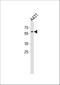 Paired Box 3 antibody, A00285, Boster Biological Technology, Western Blot image 