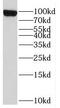 Glycogen phosphorylase, liver form antibody, FNab06976, FineTest, Western Blot image 