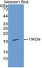 Interleukin 36 Receptor Antagonist antibody, LS-C314544, Lifespan Biosciences, Western Blot image 