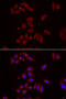 Nephrocystin 1 antibody, abx005117, Abbexa, Western Blot image 