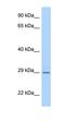 Islet Cell Autoantigen 1 Like antibody, orb325757, Biorbyt, Western Blot image 