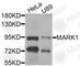 Microtubule Affinity Regulating Kinase 1 antibody, A8435, ABclonal Technology, Western Blot image 