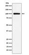 Transferrin Receptor 2 antibody, M02353-1, Boster Biological Technology, Western Blot image 