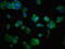 Microtubule-associated serine/threonine-protein kinase 3 antibody, LS-C671493, Lifespan Biosciences, Immunofluorescence image 