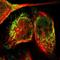 NADH:Ubiquinone Oxidoreductase Subunit B5 antibody, NBP1-85607, Novus Biologicals, Immunocytochemistry image 