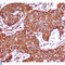 Protein Kinase AMP-Activated Non-Catalytic Subunit Beta 1 antibody, LS-C814091, Lifespan Biosciences, Immunohistochemistry paraffin image 