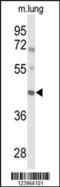 Iroquois Homeobox 2 antibody, 63-975, ProSci, Western Blot image 