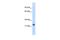 ETS Homologous Factor antibody, GTX49008, GeneTex, Western Blot image 