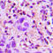 Transforming Growth Factor Beta 2 antibody, LS-C352930, Lifespan Biosciences, Immunohistochemistry paraffin image 