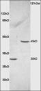 Ceramide Synthase 2 antibody, orb6298, Biorbyt, Western Blot image 