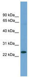 Achaete-Scute Family BHLH Transcription Factor 3 antibody, TA342342, Origene, Western Blot image 