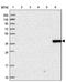 Ankyrin repeat domain-containing protein 2 antibody, NBP1-91669, Novus Biologicals, Immunohistochemistry frozen image 