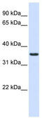 Thioredoxin-related transmembrane protein 2 antibody, TA341992, Origene, Western Blot image 