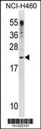 Colony Stimulating Factor 3 antibody, 60-580, ProSci, Western Blot image 