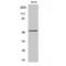 Activating Transcription Factor 2 antibody, LS-C380631, Lifespan Biosciences, Western Blot image 