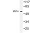 MutY DNA Glycosylase antibody, LS-C177045, Lifespan Biosciences, Western Blot image 