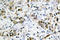 L-36 lactose-binding protein antibody, LS-C177039, Lifespan Biosciences, Immunohistochemistry paraffin image 