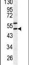 Serpin Family H Member 1 antibody, PA5-14253, Invitrogen Antibodies, Western Blot image 