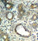 Protein Tyrosine Phosphatase Non-Receptor Type 11 antibody, AP0439, ABclonal Technology, Immunohistochemistry paraffin image 