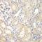 DLC1 Rho GTPase Activating Protein antibody, GTX54022, GeneTex, Immunohistochemistry paraffin image 