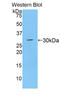 ADAM Metallopeptidase Domain 28 antibody, LS-C292560, Lifespan Biosciences, Western Blot image 