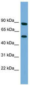 Raftlin Family Member 2 antibody, TA340342, Origene, Western Blot image 