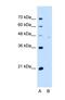 Neuroplastin antibody, NBP1-62423, Novus Biologicals, Western Blot image 