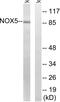 NADPH Oxidase 5 antibody, PA5-39280, Invitrogen Antibodies, Western Blot image 