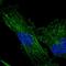 Transmembrane Protein 200C antibody, HPA047253, Atlas Antibodies, Immunofluorescence image 