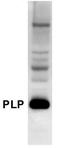 Proteolipid Protein 1 antibody, GTX79243, GeneTex, Western Blot image 