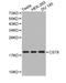 Cystatin 8 antibody, LS-C192486, Lifespan Biosciences, Western Blot image 