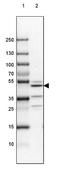 Chromosome 17 Open Reading Frame 75 antibody, NBP1-82563, Novus Biologicals, Western Blot image 