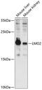 LIM Domain Only 2 antibody, 14-575, ProSci, Western Blot image 