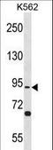 Testis Specific 10 antibody, LS-C157000, Lifespan Biosciences, Western Blot image 