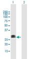 Charged Multivesicular Body Protein 1A antibody, H00005119-B01P, Novus Biologicals, Western Blot image 