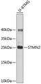 Stathmin-2 antibody, 18-900, ProSci, Western Blot image 