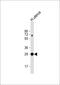 Vestigial Like Family Member 4 antibody, 60-565, ProSci, Western Blot image 