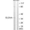 Elongation of very long chain fatty acids protein 4 antibody, A03840, Boster Biological Technology, Western Blot image 