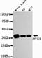 Protein Phosphatase 1 Catalytic Subunit Beta antibody, LS-C178279, Lifespan Biosciences, Western Blot image 