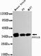 Serine/threonine-protein phosphatase PP1-beta catalytic subunit antibody, LS-C178279, Lifespan Biosciences, Western Blot image 