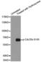 Cell Division Cycle 25B antibody, LS-C335965, Lifespan Biosciences, Western Blot image 