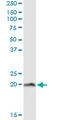 NPC Intracellular Cholesterol Transporter 2 antibody, LS-C139240, Lifespan Biosciences, Immunoprecipitation image 