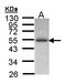 Inositol Hexakisphosphate Kinase 2 antibody, LS-C109409, Lifespan Biosciences, Western Blot image 