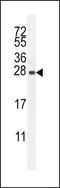 Immunity Related GTPase M antibody, LS-C165292, Lifespan Biosciences, Western Blot image 