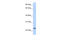 ChaC Glutathione Specific Gamma-Glutamylcyclotransferase 1 antibody, 25-788, ProSci, Western Blot image 