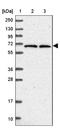 PARN Like, Ribonuclease Domain Containing 1 antibody, NBP2-13781, Novus Biologicals, Western Blot image 
